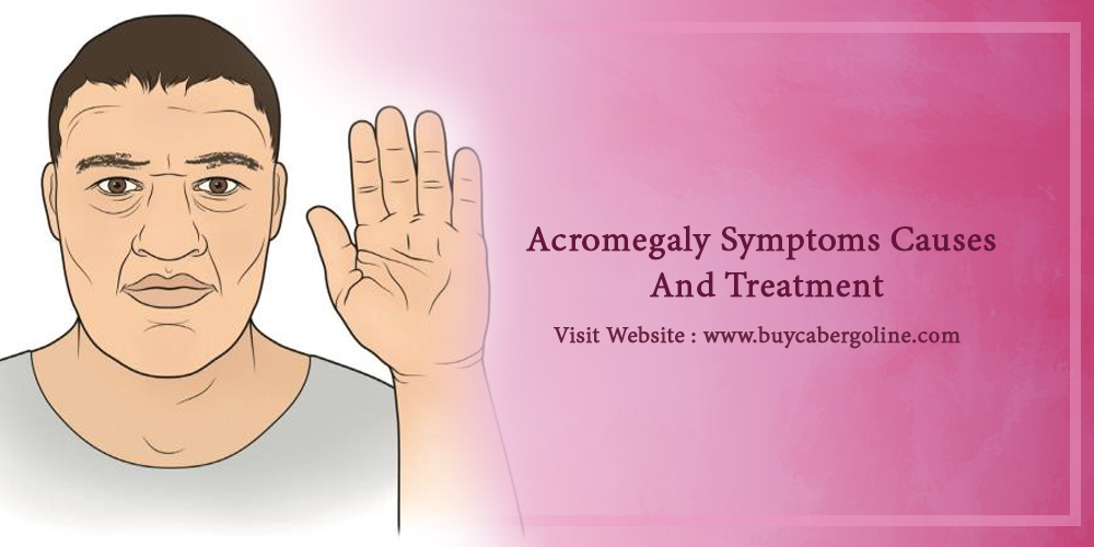 Acromegaly Symptoms Causes And Treatment